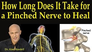 How Long Does It Take For A Pinched Nerve to Heal  Dr Mandell [upl. by Saref]