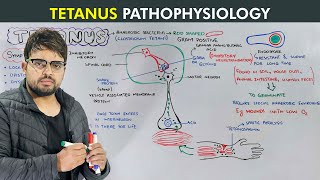 Tetanus Causes Symptoms Prevention and Treatment Biology lecture [upl. by Refinaj]