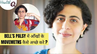 BELLS PALSY में आँखों के MOVEMETNS कैसे अच्छे करे [upl. by Noffets]