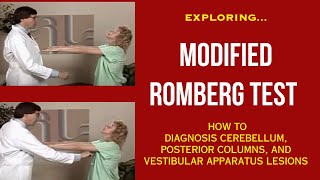 Exploring Romberg Test Diagnosis Cerebellum Posterior Columns and Vestibular Apparatus lesions [upl. by Nahtnhoj]