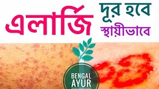 এলার্জি দূর করার সহজ উপায়  ALLERGY TREATMENT IN BANGLA  BENGAL AYUR [upl. by Patricio]