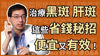 治療黑斑、肝斑，有哪些省錢又有效，高CP值的方法？醫美里長林政賢醫師大揭密！ [upl. by Oswell]