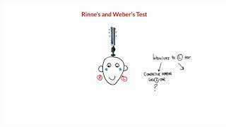 Rinnes and Webers Test [upl. by Alberto]