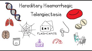 Hereditary Haemorrhagic Telangiectasia  An Overview [upl. by Pallua916]