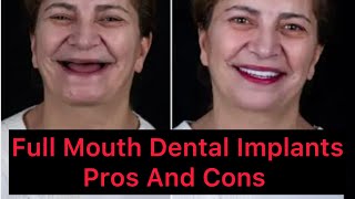 “Don’t get Full Mouth Implants Or Dentures Before Watching This “ [upl. by Howe]