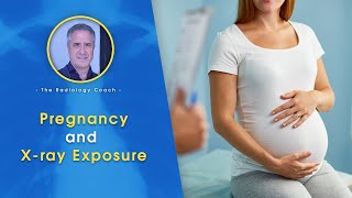 PREGNANCY and X ray EXPOSURE [upl. by Noakes720]