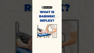 Understanding the Babinski Reflex A key neurological exam 🧠 Subscribe for more medical tips [upl. by Bergmans]