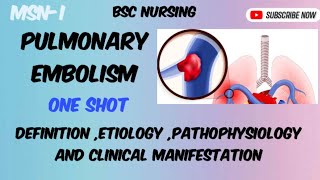 Pulmonary Embolism  part1 Bsc nursing semIII [upl. by Hallutama]