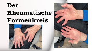 Der Rheumatische Formenkreis Podologin Andrea erklärt [upl. by Mencher]