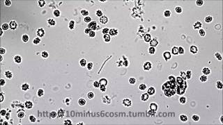 Capnocytophaga sputigena twitching motility [upl. by Madi373]