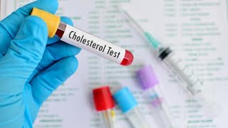 Cholesterol test biochemstry lab [upl. by Soilissav882]