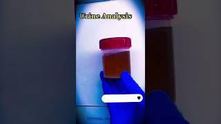 Urine Analysis Complete  Urine RE  bacteria microscope science 1millionviews viral shorts [upl. by Ativ150]