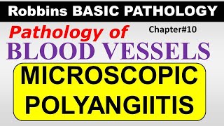 Ch10  MICROSCOPIC POLYANGIITIS  Blood Vessel Pathology  Robbins Lectures [upl. by Herzog846]