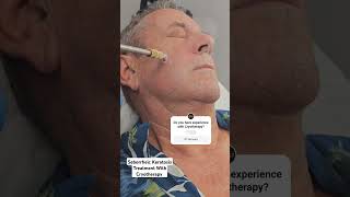 Seborrheic Keratosis treatment on the face with Cryotherapy medicalprocedurevideos dermatologist [upl. by Latea966]