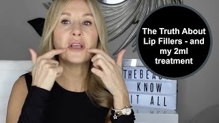 The Truth About Lip Fillers and my 2ml injections  Nadine Baggott [upl. by Nnywg39]