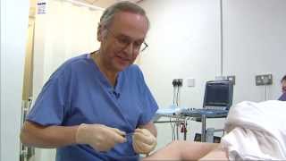 Foam sclerotherapy for varicose veins  a patients view  Philip Coleridge Smith [upl. by Atileda]