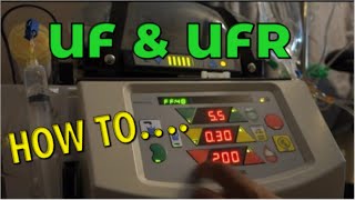 How To Input Setting On The NxStage System One UF And UFR Full Tutorial For Home Dialysis Patients [upl. by Jessabell]