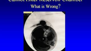 Interventional Tx for Chronic Pain Ronald Kaplan MD [upl. by Aramoy]