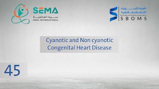 Cyanotic and non cyanotic Congenital heart disease  الدكتور أنس سلقيني [upl. by Esinek657]