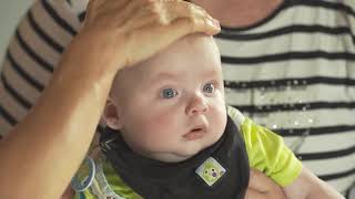 Milchschorf und Kopfgneis sanft entfernen mit BabyBene Gel [upl. by Neahs]