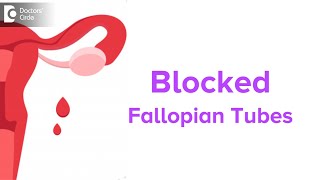 Blocked Fallopian Tubes Symptoms Fertility Issues amp Treatment  Dr Jyothi Patil  Doctors Circle [upl. by Sheeb]