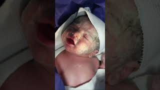 My newborn baby with Vernix Caseosa Just after birth cutebabyboy baby babyborn newbornbaby [upl. by Fanny423]