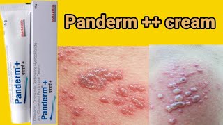 Panderm  Cream  All type of skin allergy  medicinesknowledge [upl. by Ratib277]