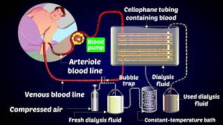 How a Dialysis Machine Works  Dialysis  ARTIFICIAL KIDNEYS [upl. by Ziwot]