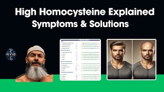 High Homocysteine Explained Hair loss Symptoms and Solutions [upl. by Binky]