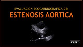 ESTENOSIS AORTICA Evaluacion ecocardiografica  PARTE 3 [upl. by Adolfo]