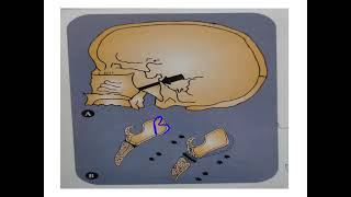 synchondrosis [upl. by Ekram]