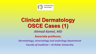 Clinical Dermatology OSCE Cases 1 [upl. by Arlana207]