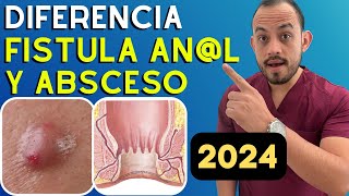 🚩 Absceso y Fistula anorrectal Diferencias Diagnostico y Tratamiento Resumido 2024 [upl. by Allyce935]