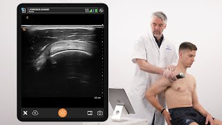 Dynamic Assessment of Ligaments of the Coracoid Process and Supraspinatus Tendon [upl. by Anoel]