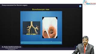 Bronchoscopic view of various segments [upl. by Onitnevuj312]