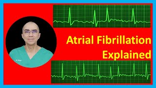 Atrial Fibrillation Explained [upl. by Estevan]