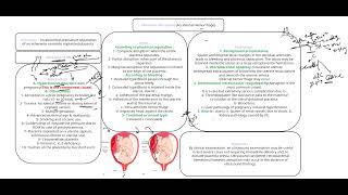 placental abruption [upl. by Licec]