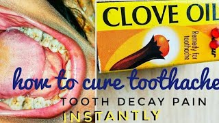 😥How To CURE Tooth Pain  Dos and Donts  CLOVE OIL BENEFITS  The Best Toothache RELIEVER [upl. by Lipski]