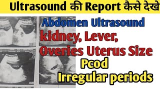 Ultrasound की Report कैसे देखे Abdomen ultrasound [upl. by Oirasan827]