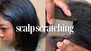 Scalp scratching Picking Dandruff [upl. by Ingrid]