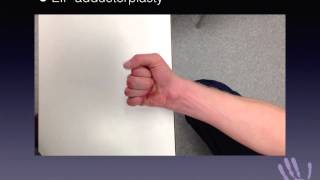 1 minute masterclass EIP adductorplasty for combined high ulnar and median nerve injury [upl. by Abigael]