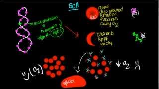 Pathophysiology of Sickle Cell Anemia [upl. by Elly]