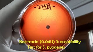 Bacitracin Sensitive Betahaemolytic Streptococci Streptococcus pyogenes [upl. by Airyk]