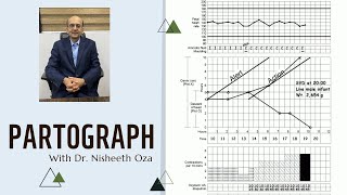 Partograph  DrOzaConnects in Hindi  Dr Nisheeth Oza [upl. by Wilser801]