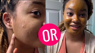 7 DAY TURMERIC amp HONEY FACE MASK  CHALLENGE [upl. by Aicatsana721]