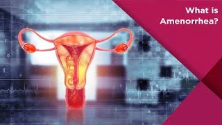 Amenorrhea Absence of Menses  Causes  symptoms amp treatment  Medical Mind [upl. by Martinez729]