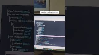 here is a medical coding practice question where Im using the electronic version of the ICD10CM [upl. by Atat]