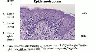 Histopathology 4 👉 Spongiosis amp Epidermotropism [upl. by Fortuna]