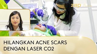 Laser Fractional CO2 Untuk Atasi Berbagai Permasalahan Kulit Anda [upl. by Linzer]