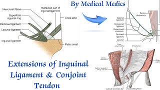 Inguinal Ligament  Extensions of Inguinal Ligament  Conjoint Tendon  Medical Medics [upl. by Ermentrude]